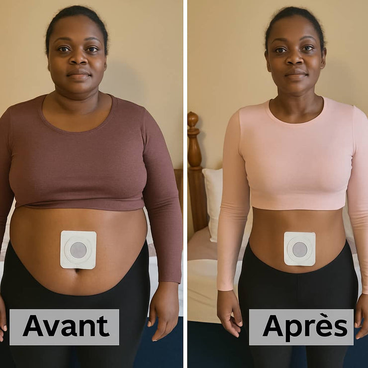 BOÎTE DE 30 PATCHS AMINCISSANTS